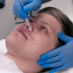 Газожидкостный пилинг Jet Peel для мужчин